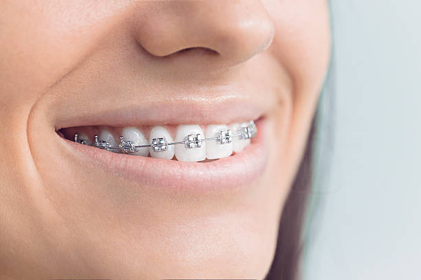 Best Veneers and Lumineers  in Natalbany, LA